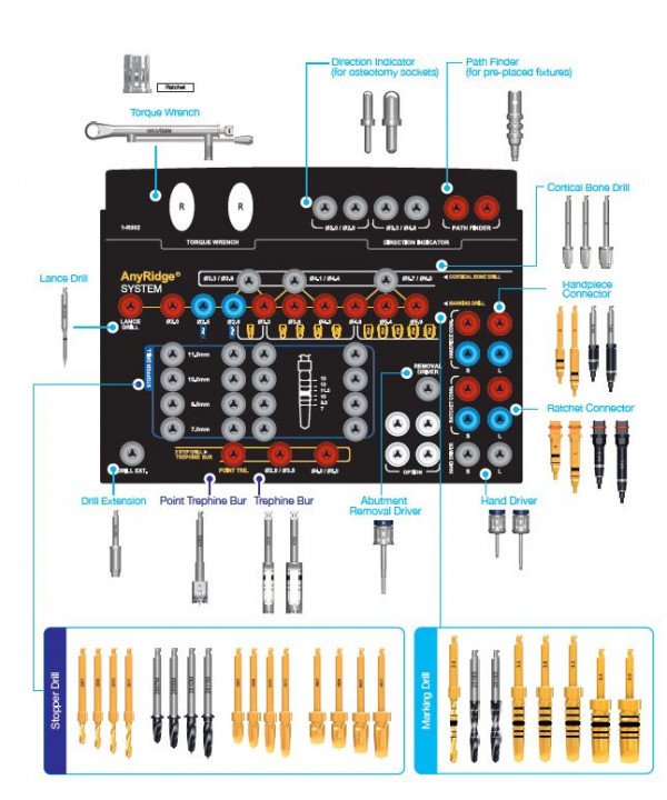 ANYRIDGE SURGICAL KIT (FULL)